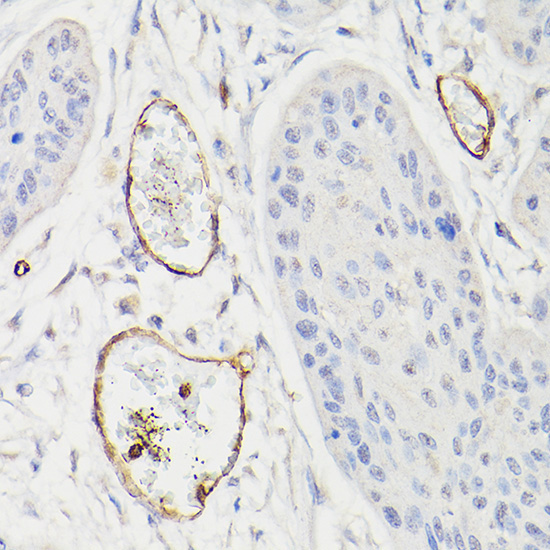 CD34 Rabbit Polyclonal Antibody