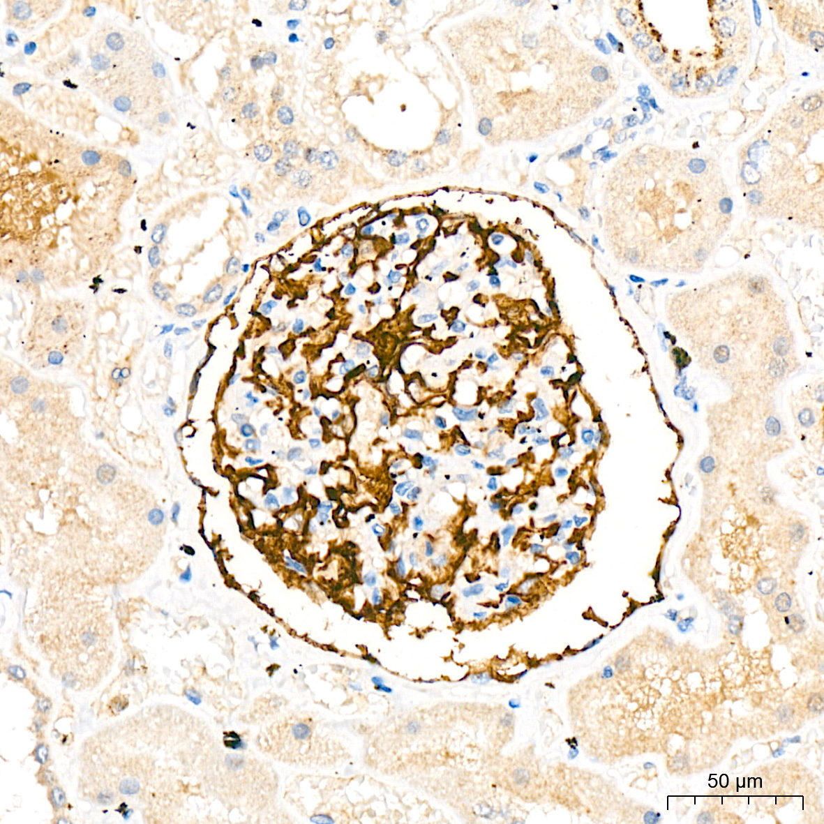 CD35 Rabbit Monoclonal Antibody - Image 2