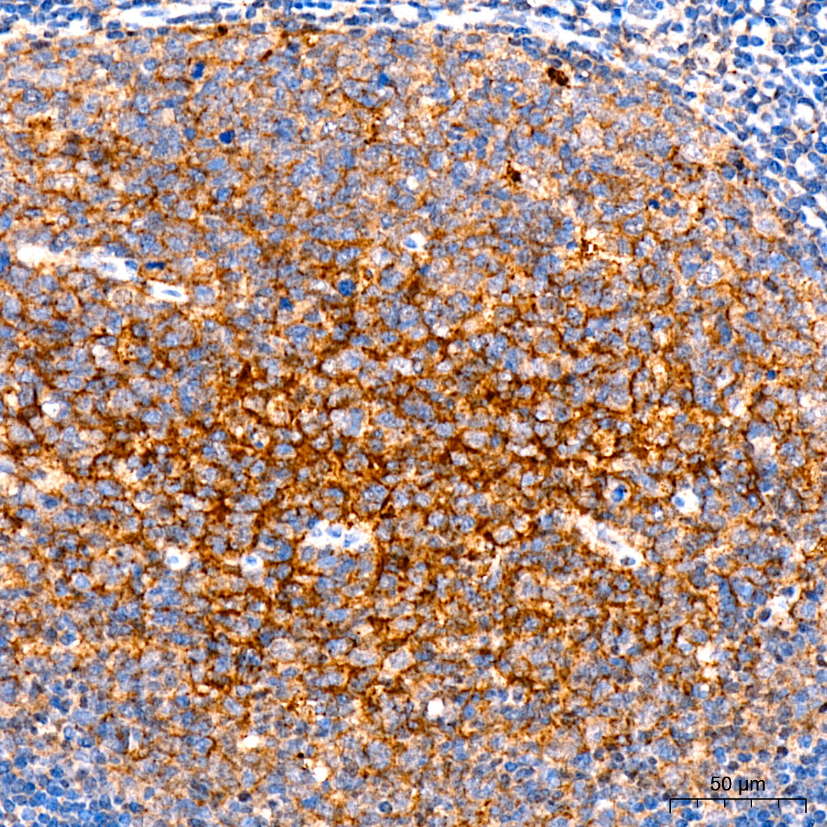 CD35 Rabbit Monoclonal Antibody - Image 3