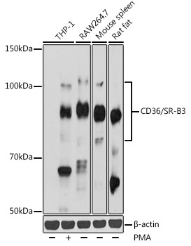 CD36/SR-B3 Rabbit Polyclonal Antibody