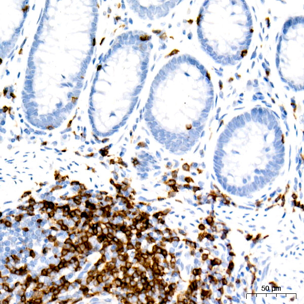 CD3E Rabbit Monoclonal Antibody - Image 2
