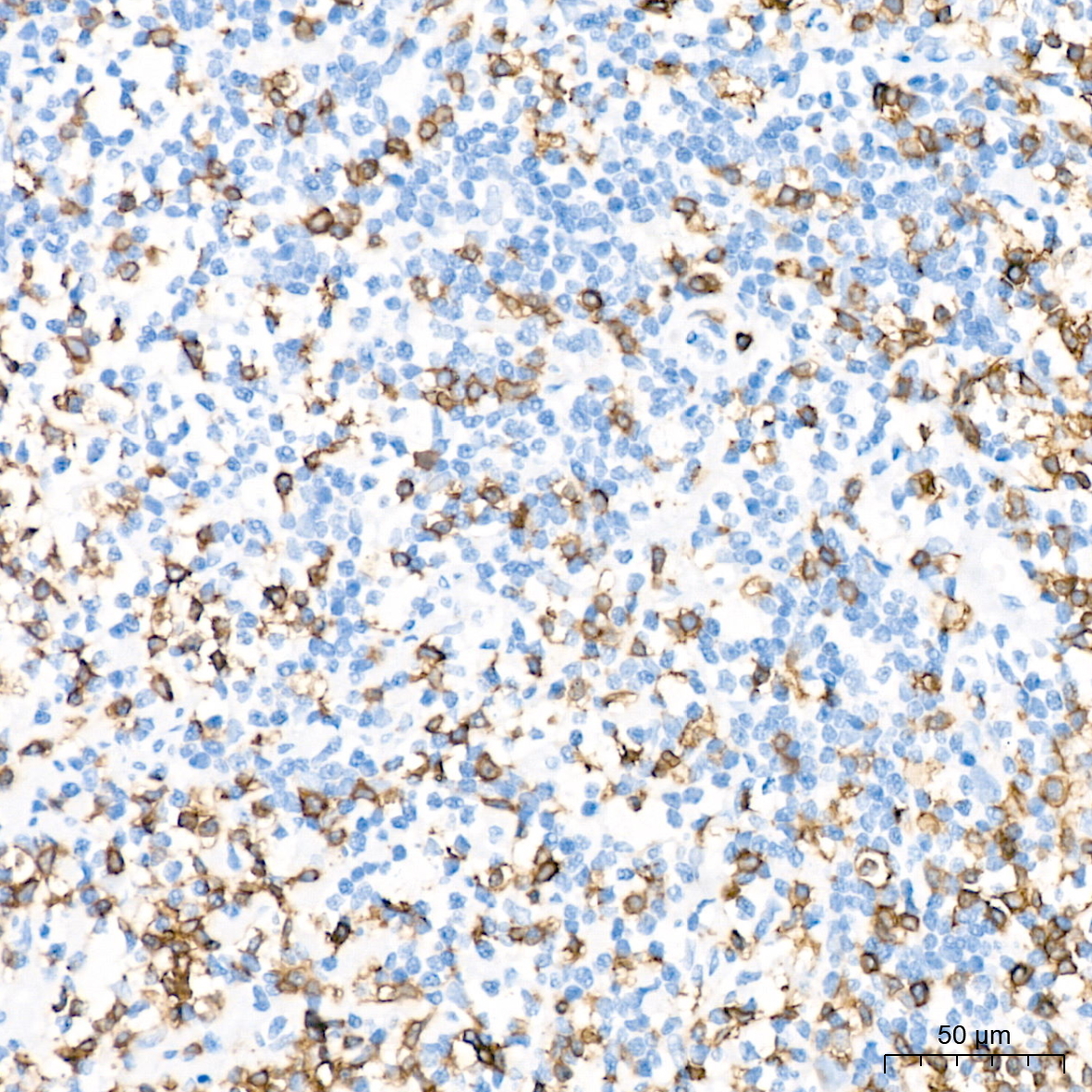 CD3E Rabbit Monoclonal Antibody - Image 3