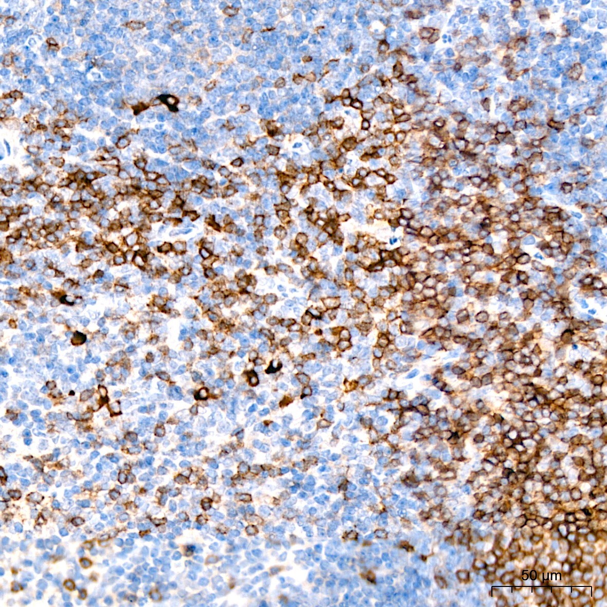 CD3E Rabbit Polyclonal Antibody