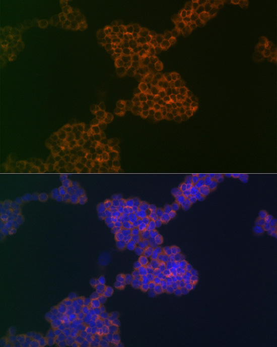 CD3G Rabbit Monoclonal Antibody - Image 2