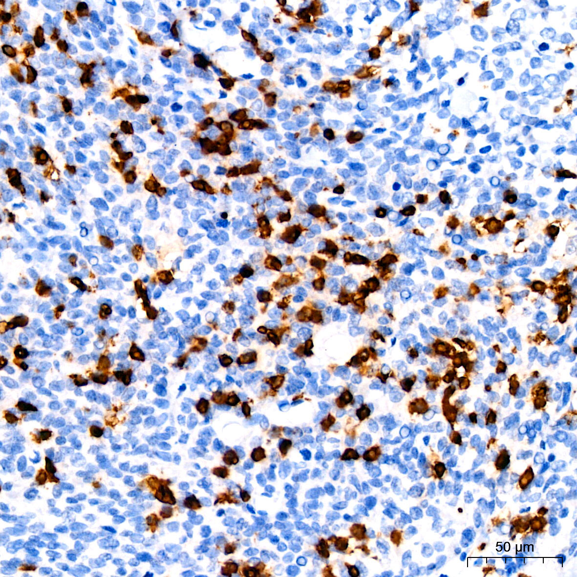 CD3G Rabbit Monoclonal Antibody - Image 3