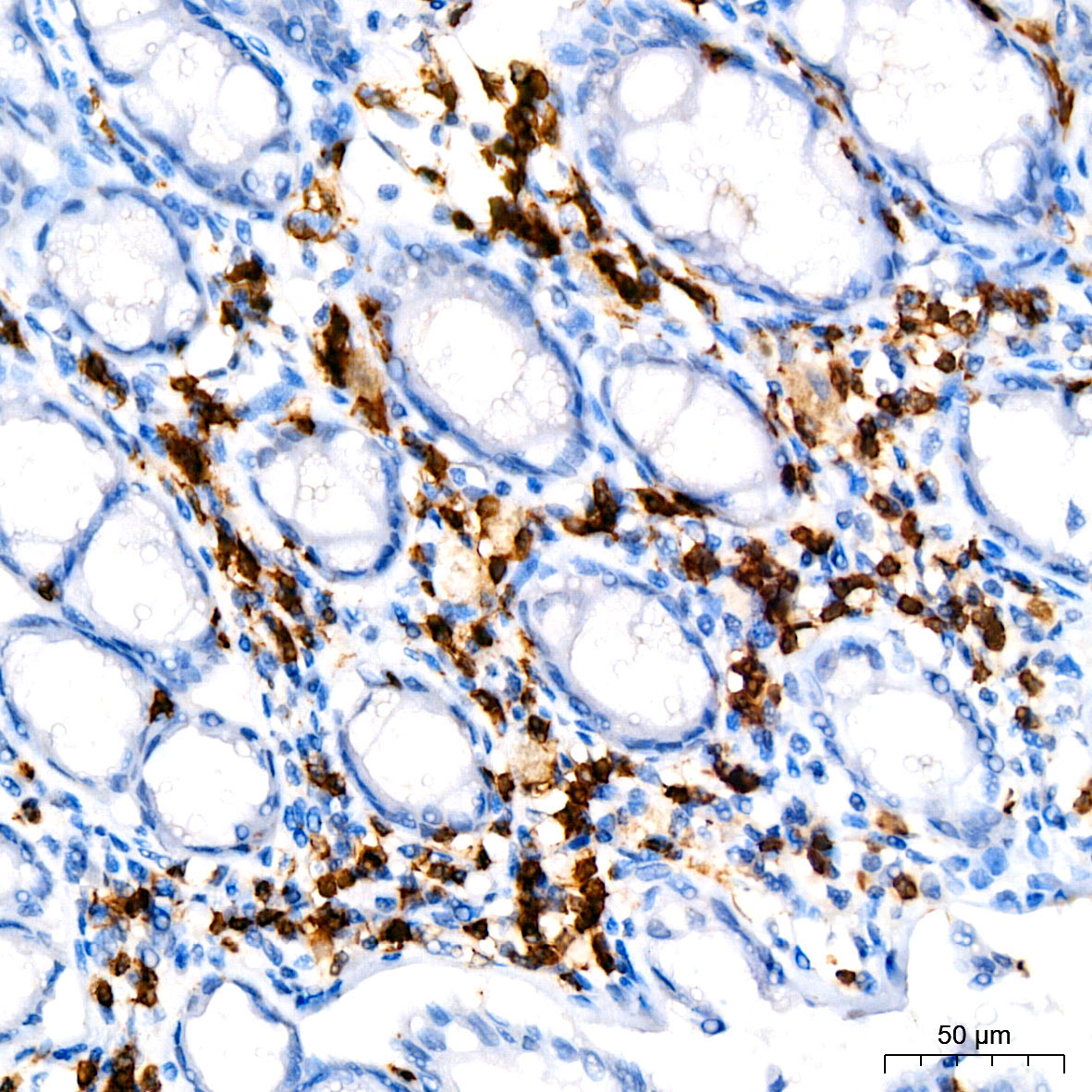 CD3G Rabbit Monoclonal Antibody - Image 4