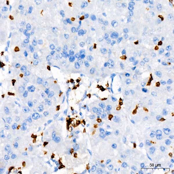 CD3G Rabbit Monoclonal Antibody - Image 5
