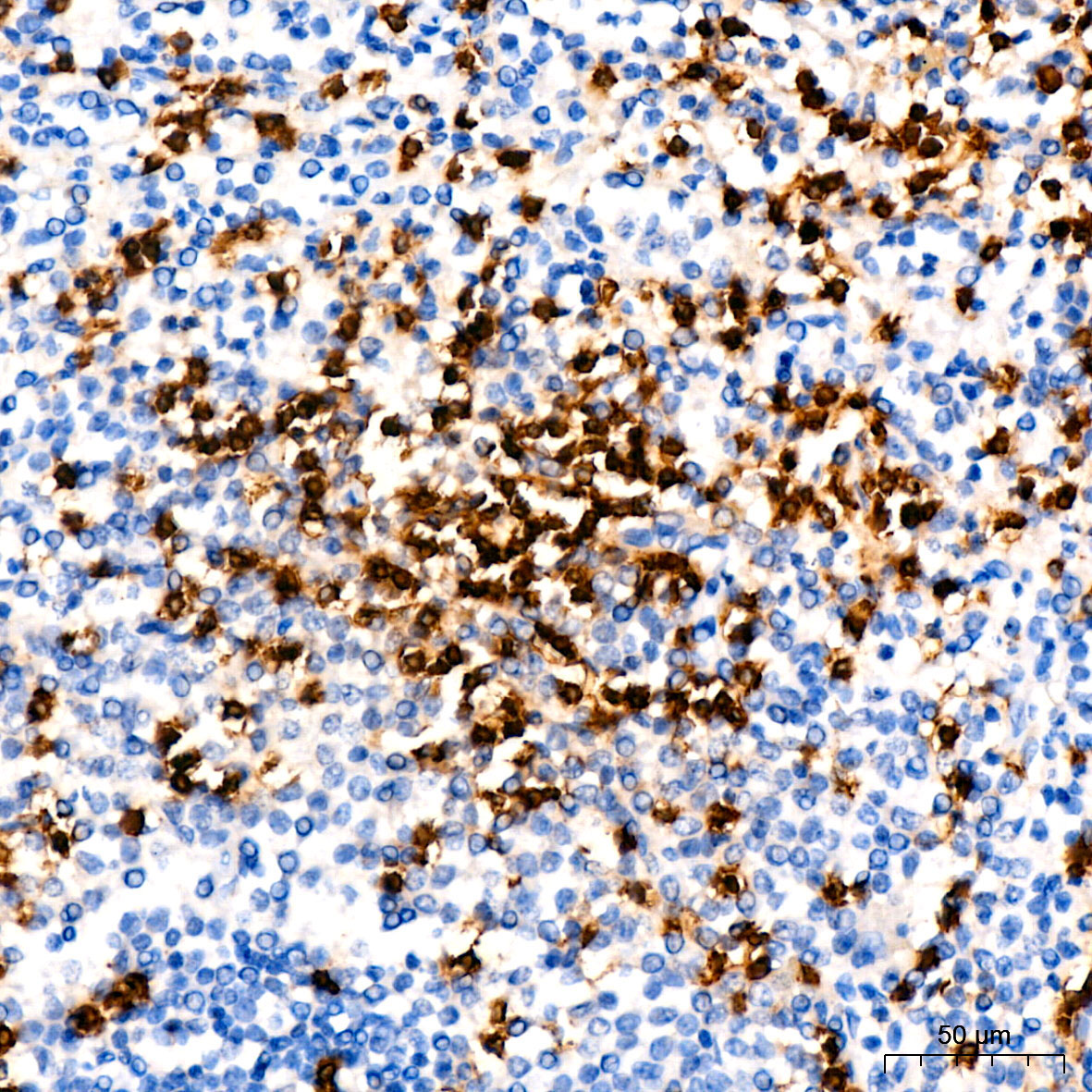 CD3G Rabbit Monoclonal Antibody - Image 7