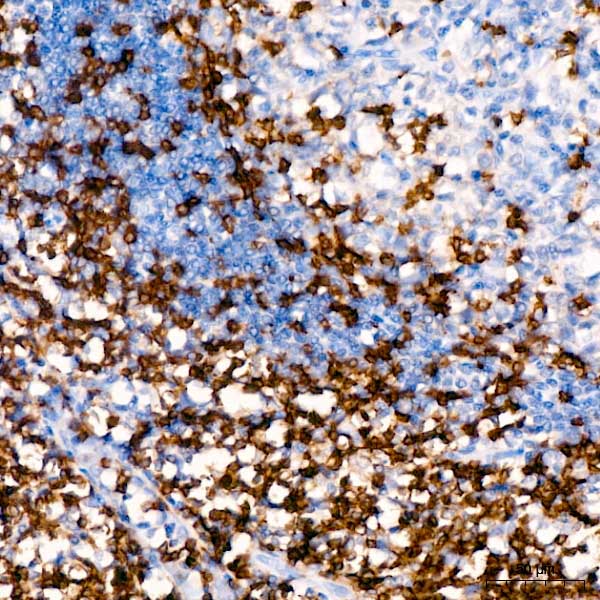 CD3G Rabbit Monoclonal Antibody - Image 8