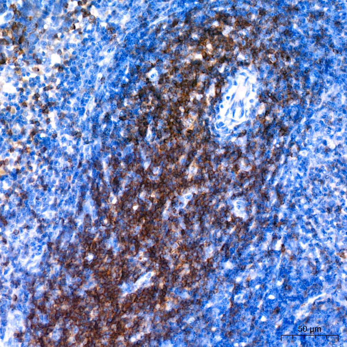 CD3G Rabbit Monoclonal Antibody - Image 10