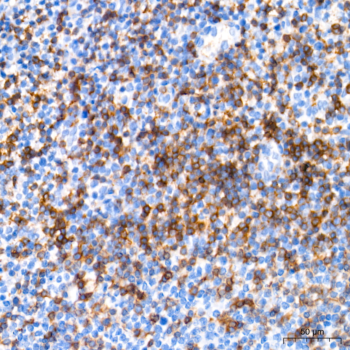 CD3H Rabbit Monoclonal Antibody - Image 2
