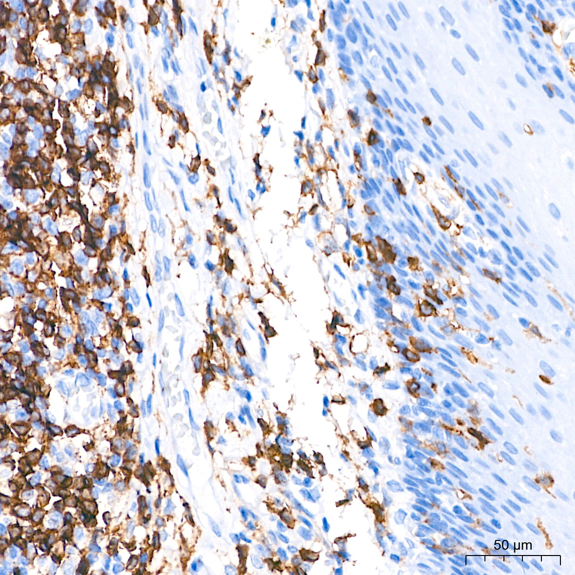 CD4 Rabbit Monoclonal Antibody - Image 2