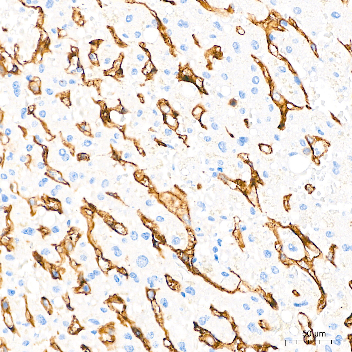 CD4 Rabbit Monoclonal Antibody - Image 3