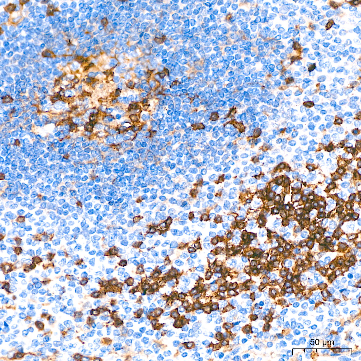 CD4 Rabbit Monoclonal Antibody - Image 4