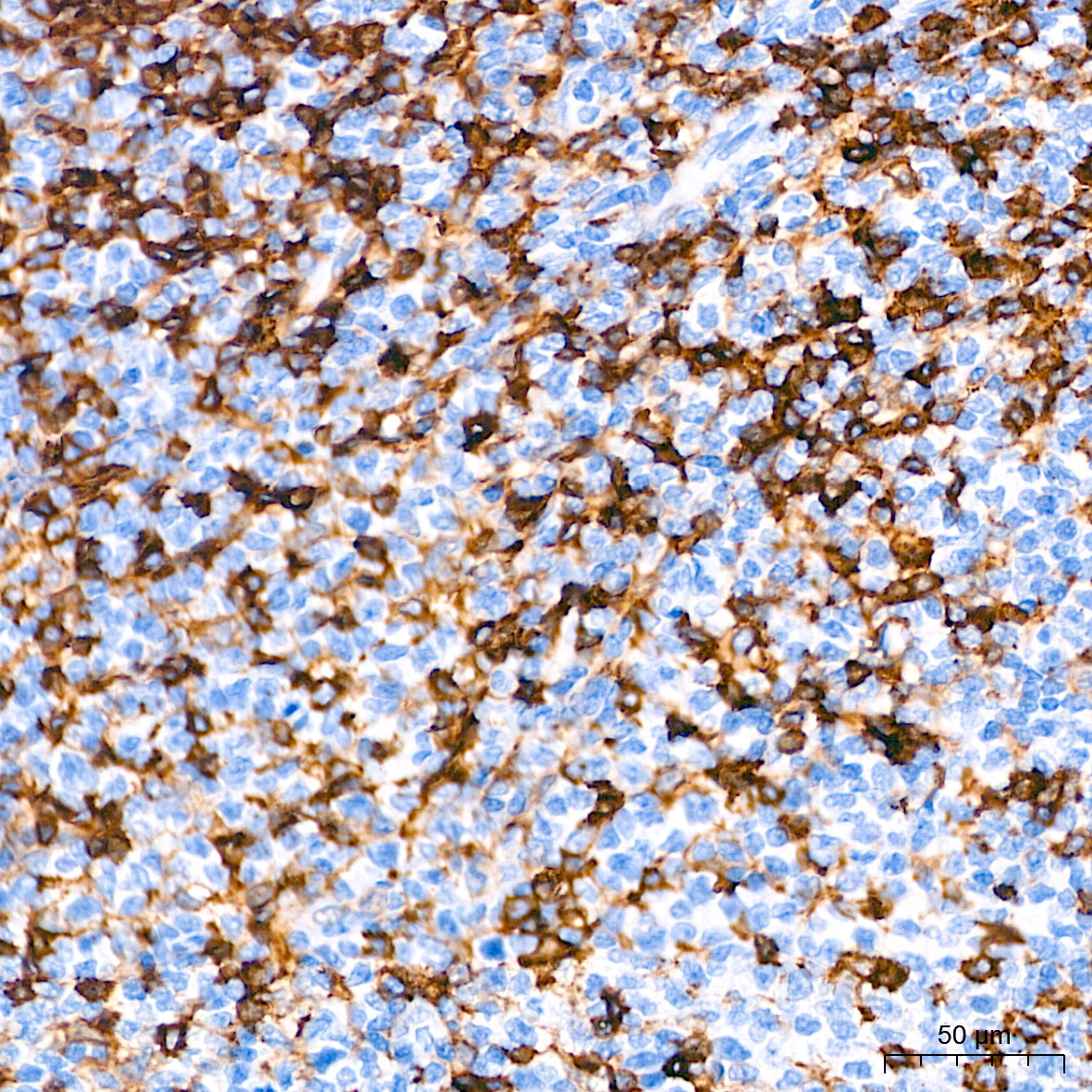 CD4 Rabbit Monoclonal Antibody - Image 5