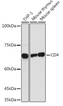 CD4 Rabbit Polyclonal Antibody