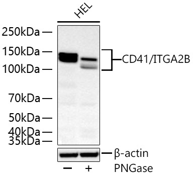 CD41/ITGA2B Rabbit Monoclonal Antibody