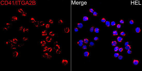 CD41/ITGA2B Rabbit Polyclonal Antibody