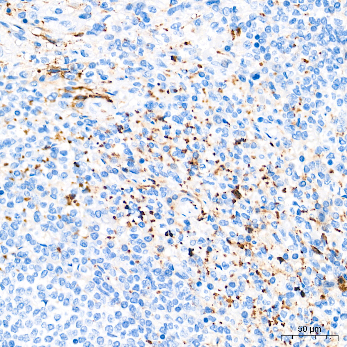 CD42b Rabbit Monoclonal Antibody - Image 3