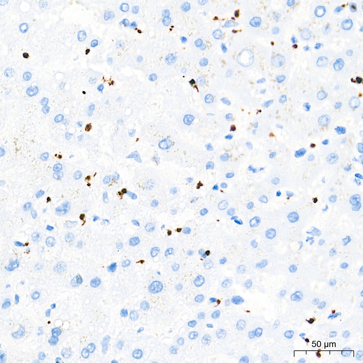 CD42b Rabbit Monoclonal Antibody - Image 4