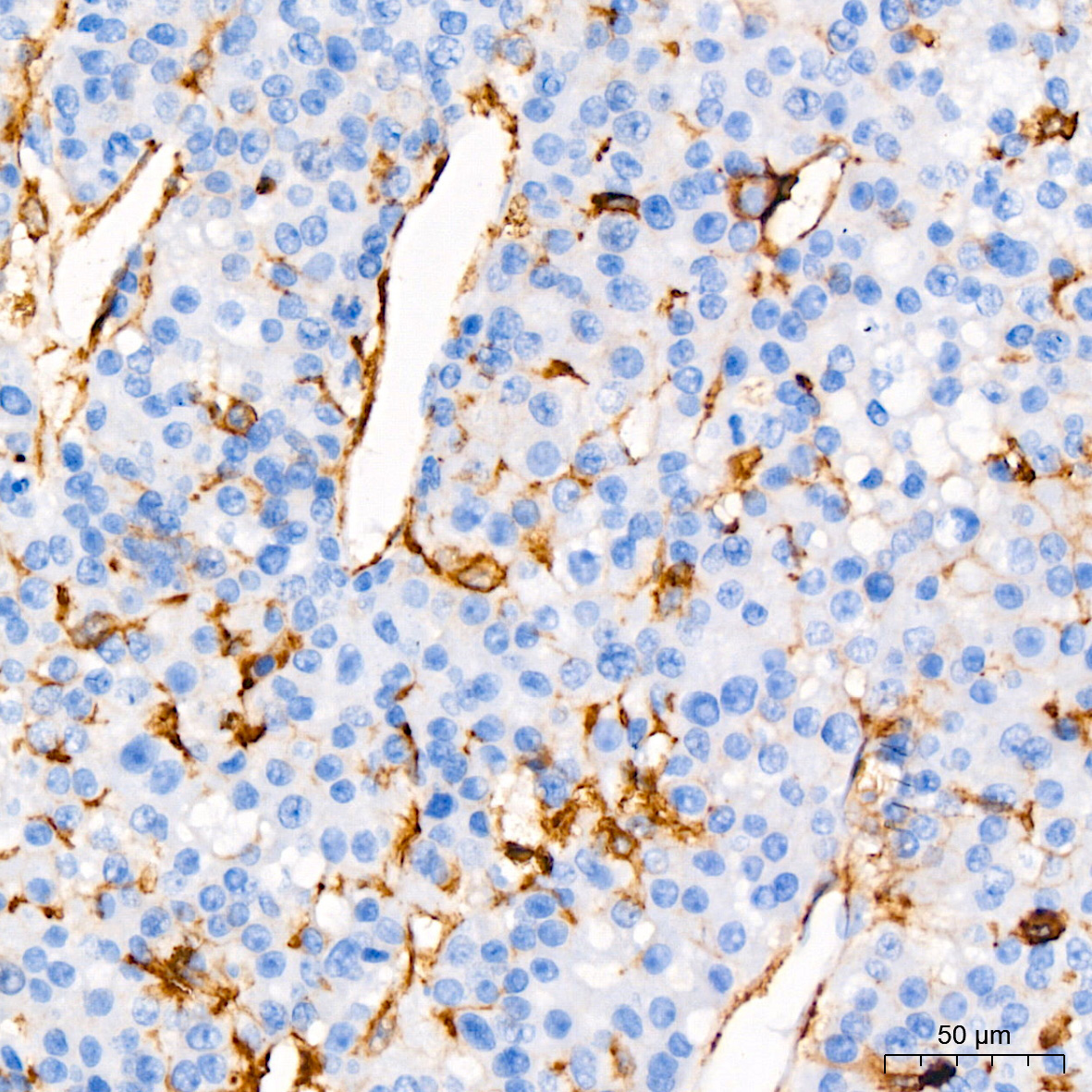CD44 Rabbit Monoclonal Antibody - Image 3