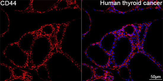 CD44 Rabbit Monoclonal Antibody - Image 8