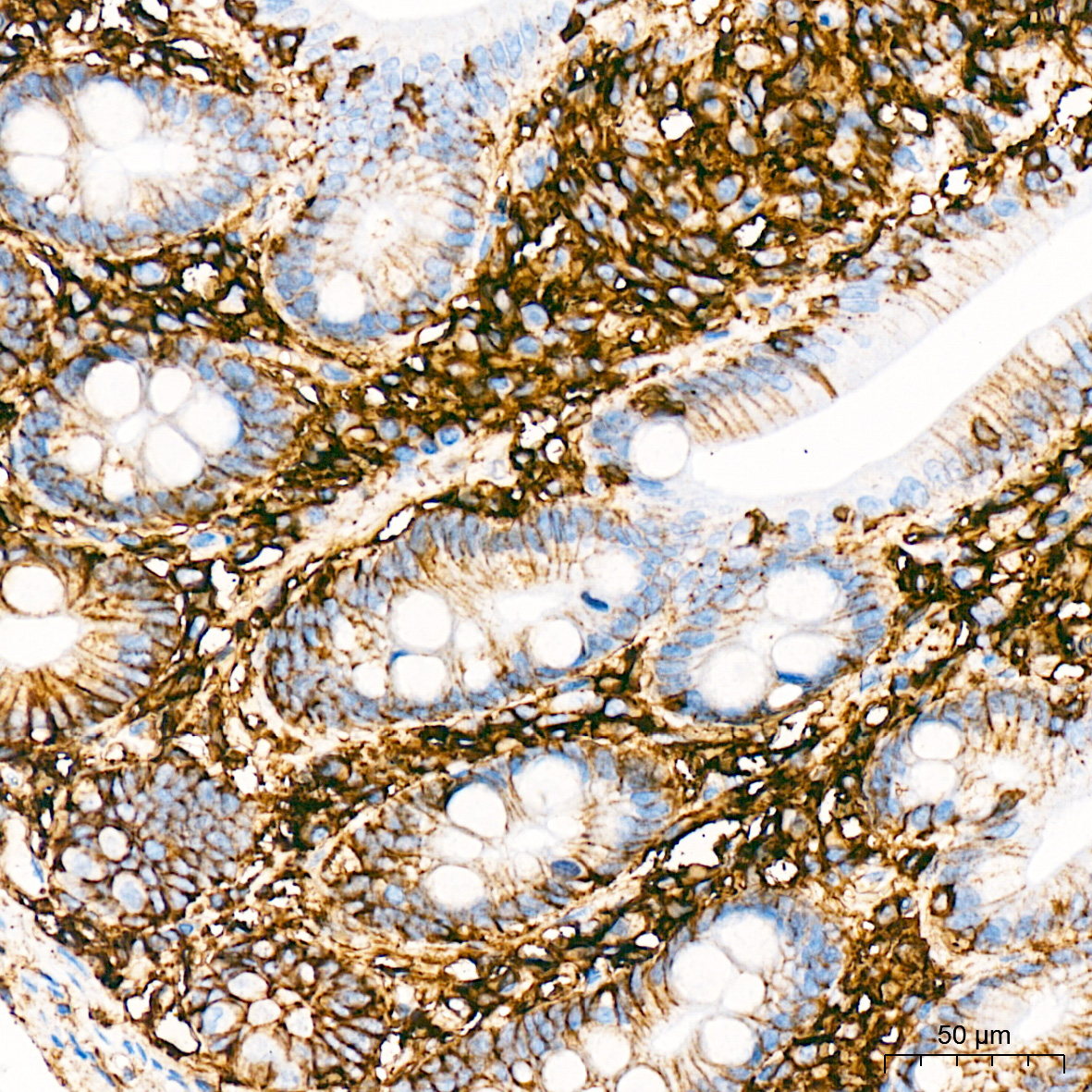CD44 Rabbit Monoclonal Antibody - Image 2