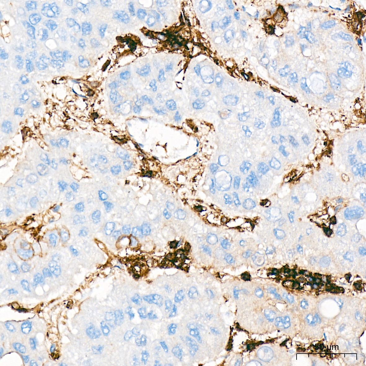 CD44 Rabbit Monoclonal Antibody - Image 3
