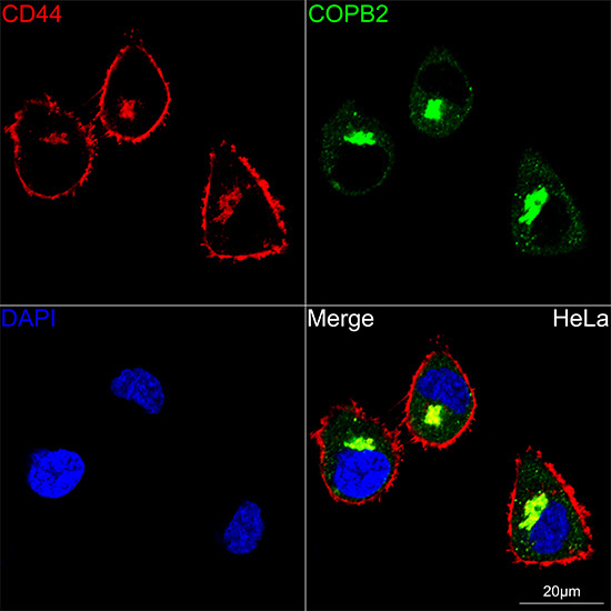 CD44 Rabbit Monoclonal Antibody - Image 5