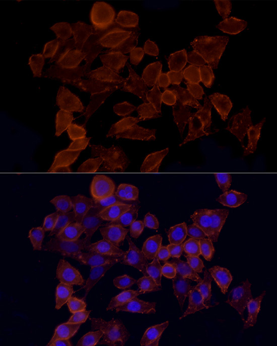 CD44 Rabbit Polyclonal Antibody