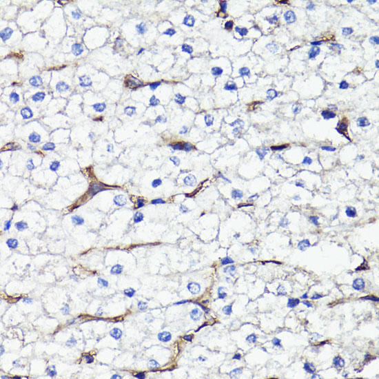 CD44 Rabbit Polyclonal Antibody