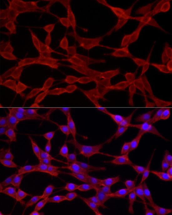 CD44 Rabbit Polyclonal Antibody - Image 2