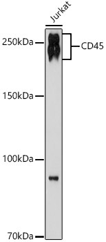 CD45 Rabbit Monoclonal Antibody