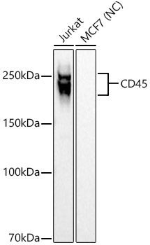 CD45 Rabbit Monoclonal Antibody
