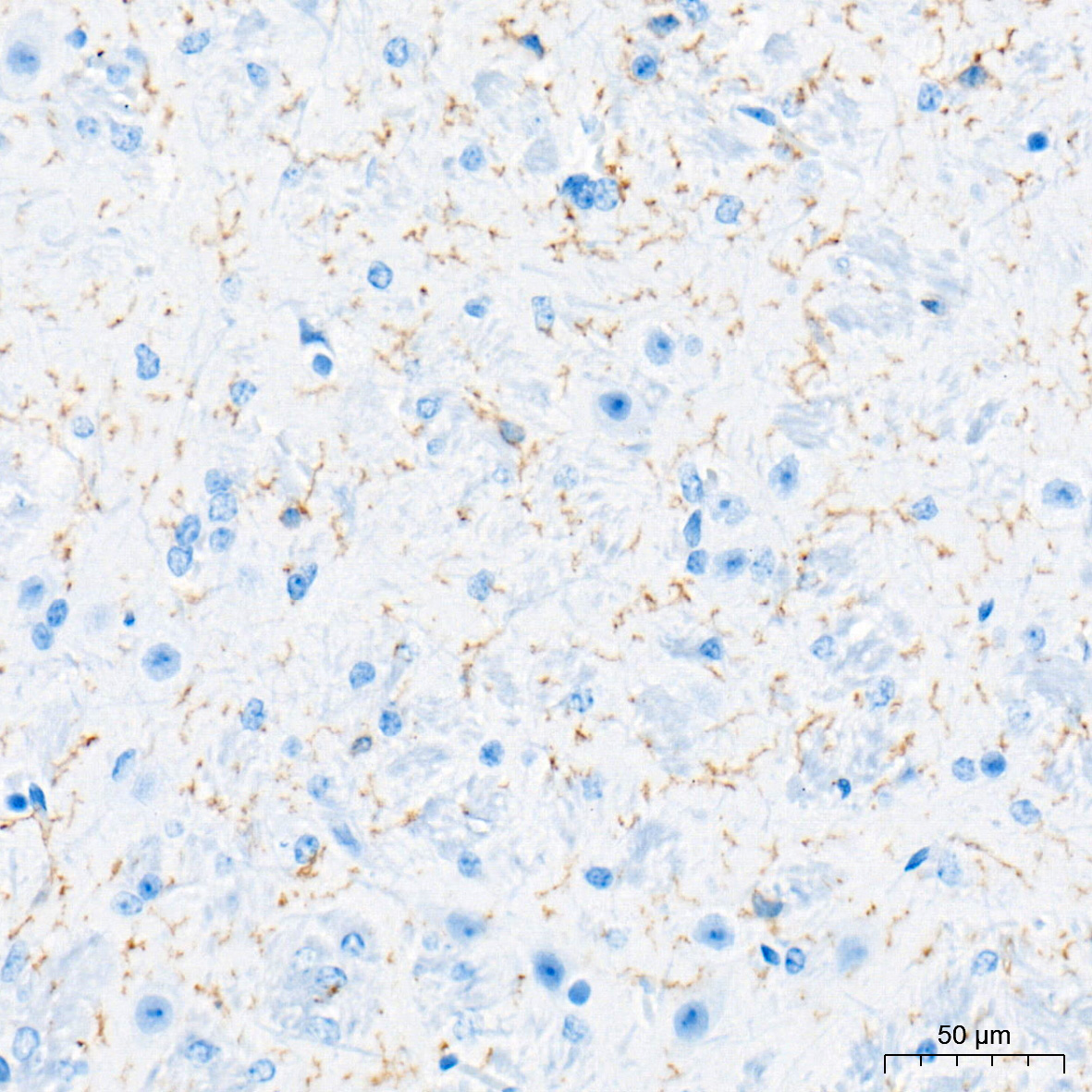 CD45 Rabbit Monoclonal Antibody
