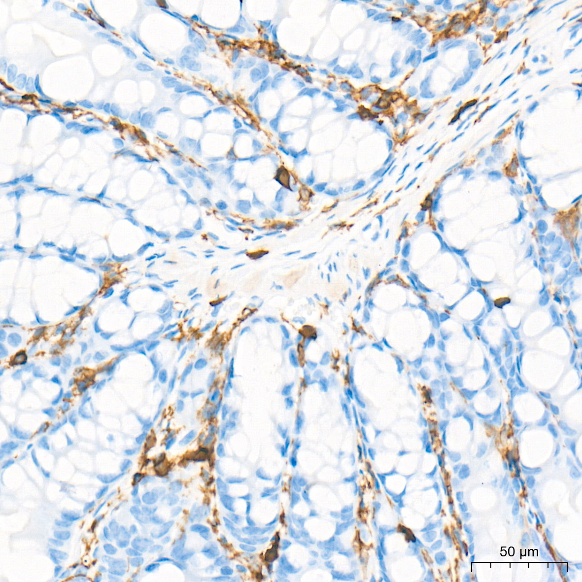 CD45 Rabbit Monoclonal Antibody - Image 2