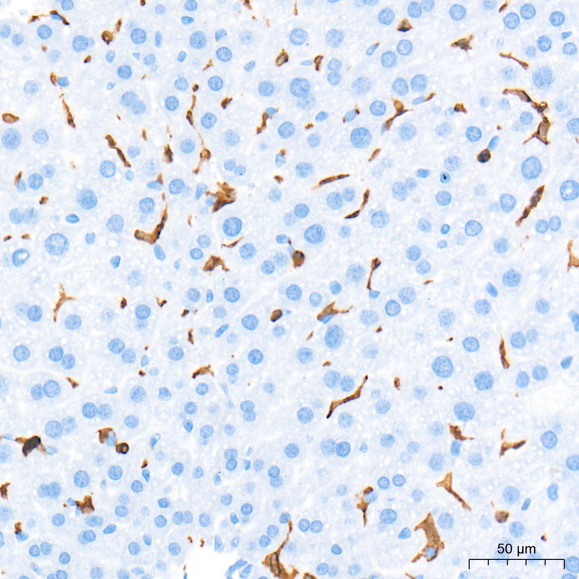 CD45 Rabbit Monoclonal Antibody - Image 3