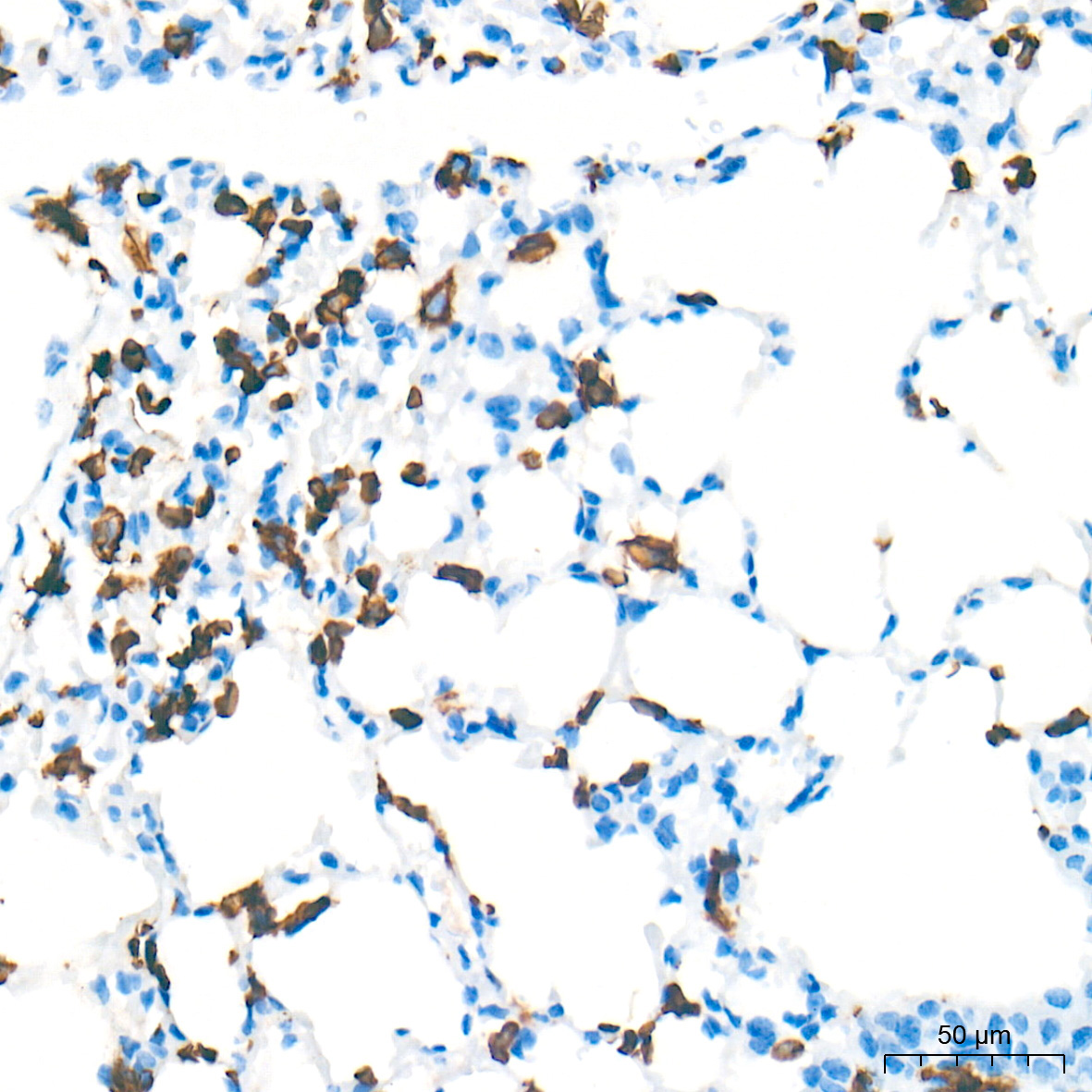 CD45 Rabbit Monoclonal Antibody - Image 4