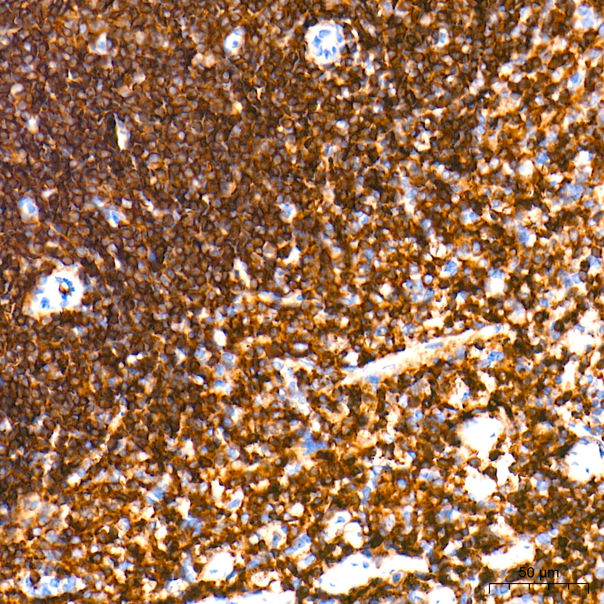 CD45 Rabbit Monoclonal Antibody - Image 5