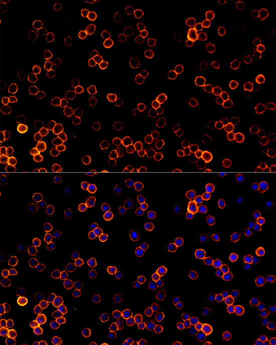 CD45 Rabbit Monoclonal Antibody - Image 6