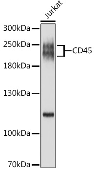 CD45 Rabbit Polyclonal Antibody