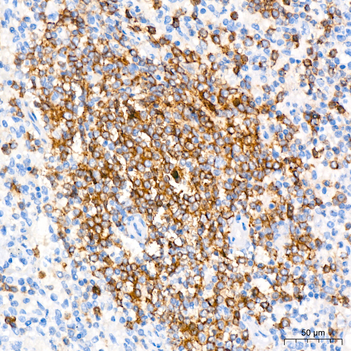 CD45RA Rabbit Monoclonal Antibody