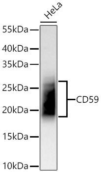 CD59 Rabbit Monoclonal Antibody