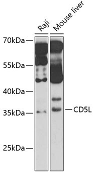CD5L Rabbit Polyclonal Antibody