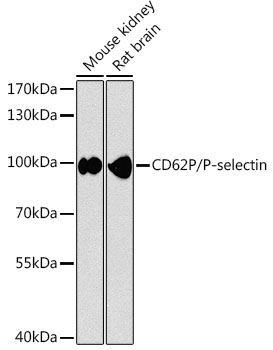 CD62P/P-selectin Rabbit Polyclonal Antibody