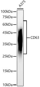 CD63 Rabbit Polyclonal Antibody