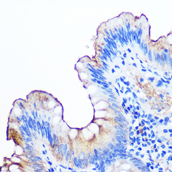 CD66a/CEACAM1 Rabbit Monoclonal Antibody - Image 2