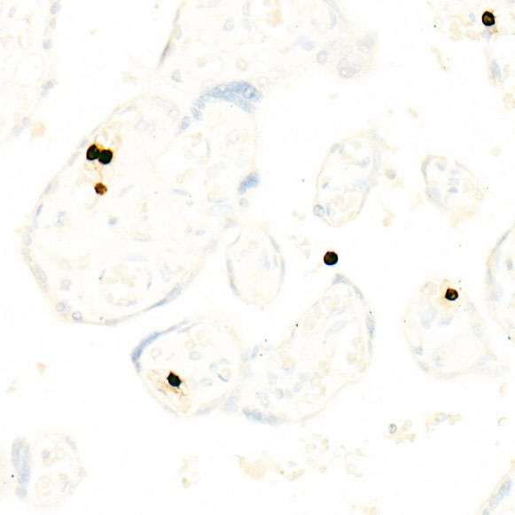 CD66b/CEACAM8 Rabbit Monoclonal Antibody