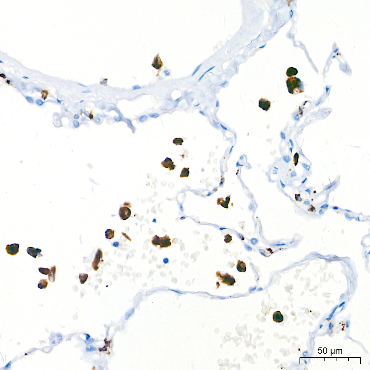 CD68 Rabbit Monoclonal Antibody - Image 2