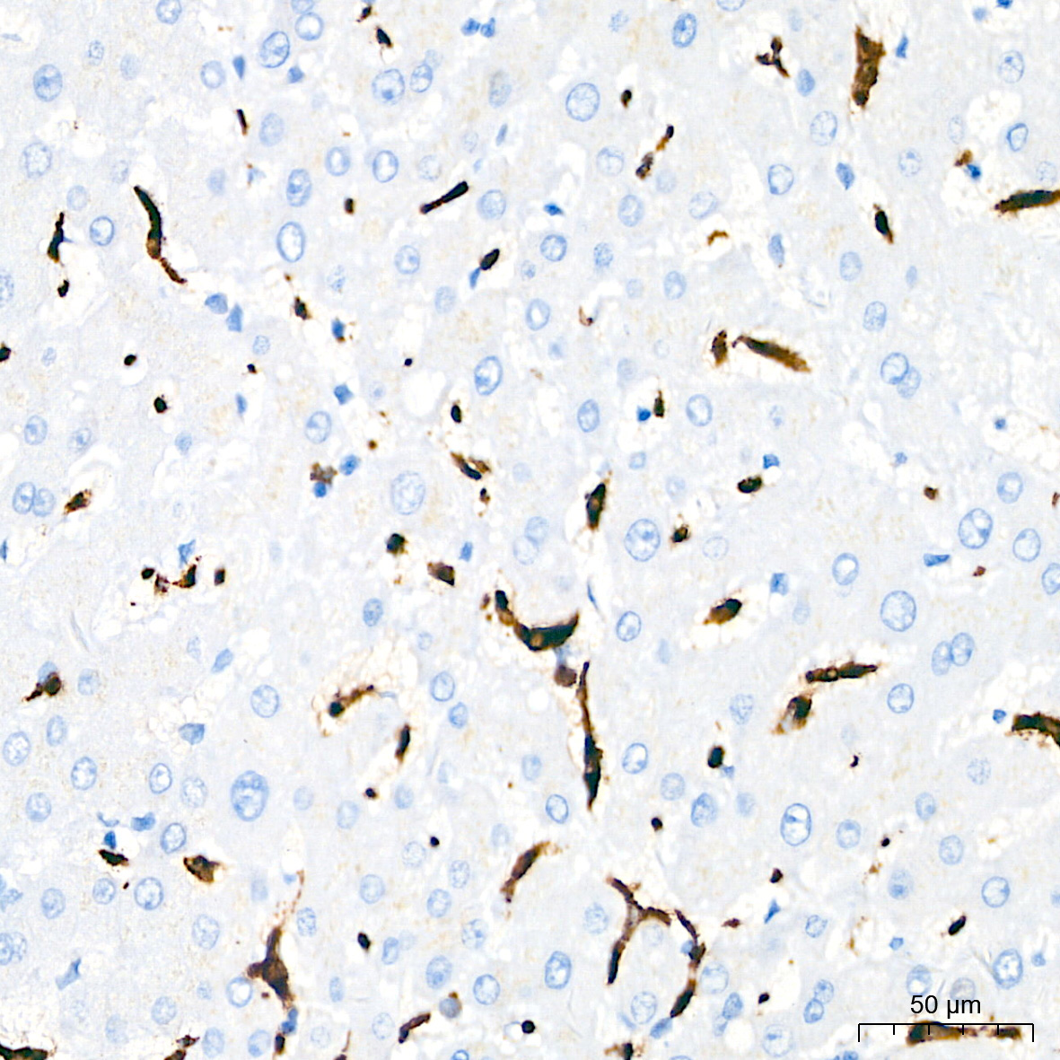 CD68 Rabbit Monoclonal Antibody - Image 3